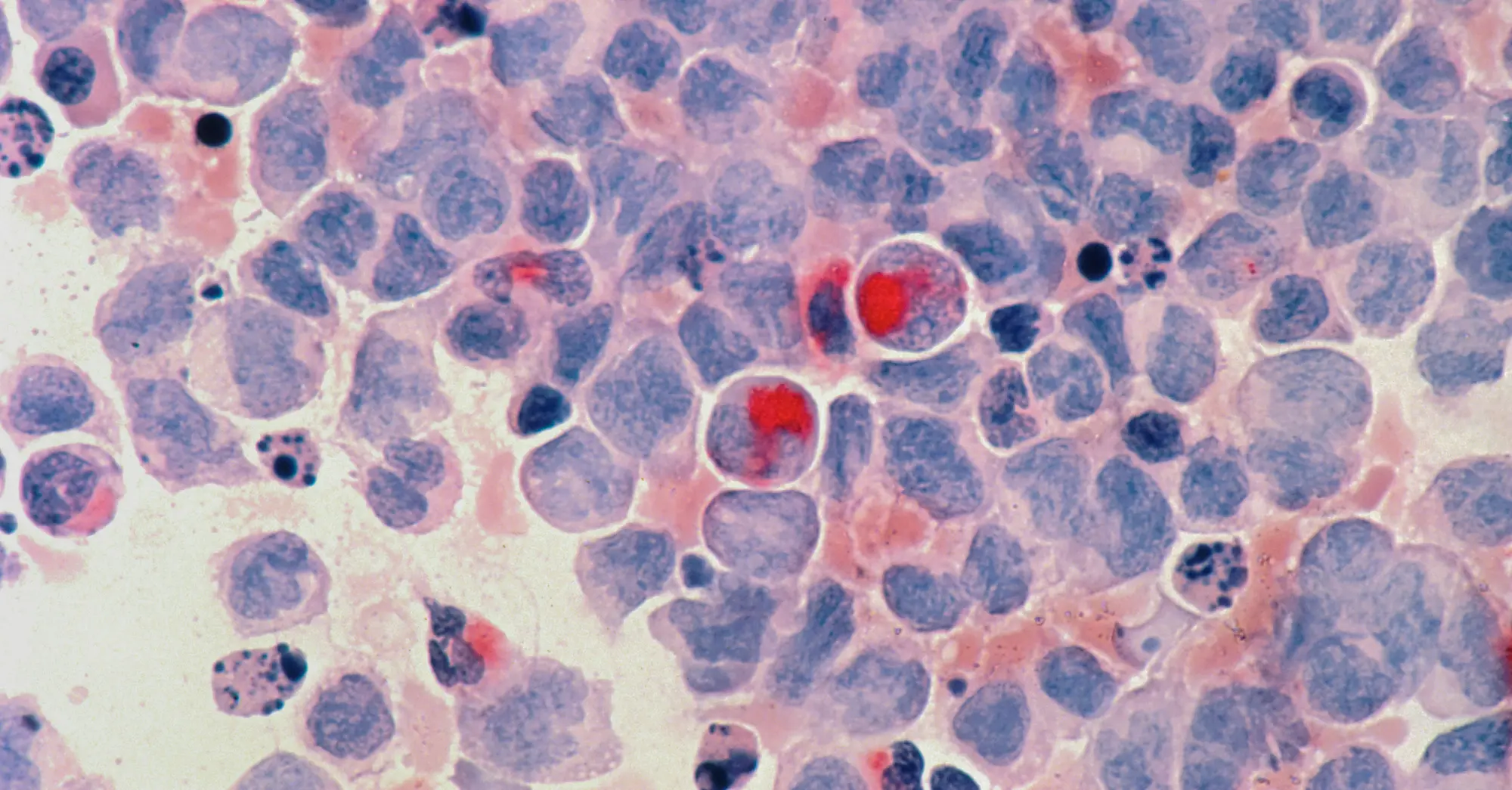 microscopic cellular photo